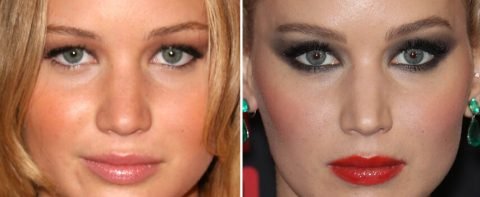 Celebrities Who Have Had Blepharoplasty Before and After