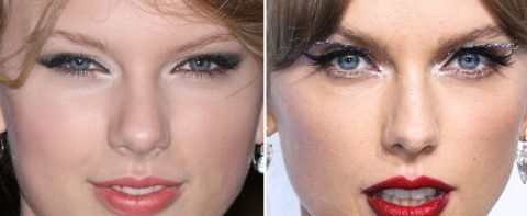 Celebrities Who Have Had Blepharoplasty Before and After