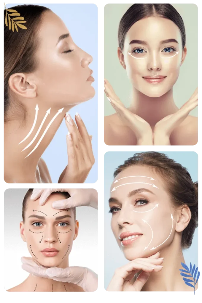 benefits of endoscopic facelift
