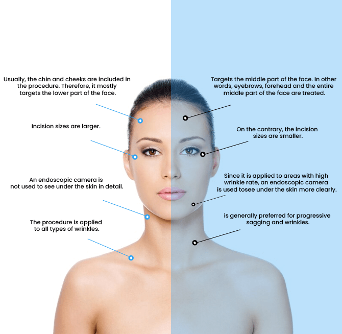 difference between endoscopic facelift and traditional facelift