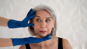 smas facelift surgery