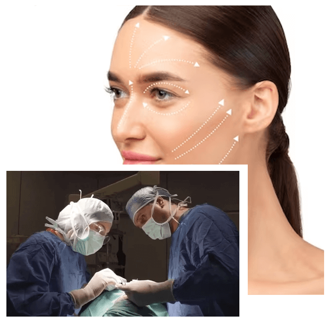 what is endoscopic facelift
