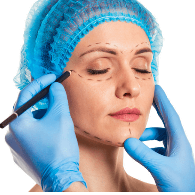 Subperiosteal Facelift in Turkey