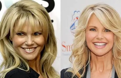 Best Celebrity Facelifts Before and After