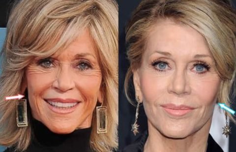 Best Celebrity Facelifts Before and After