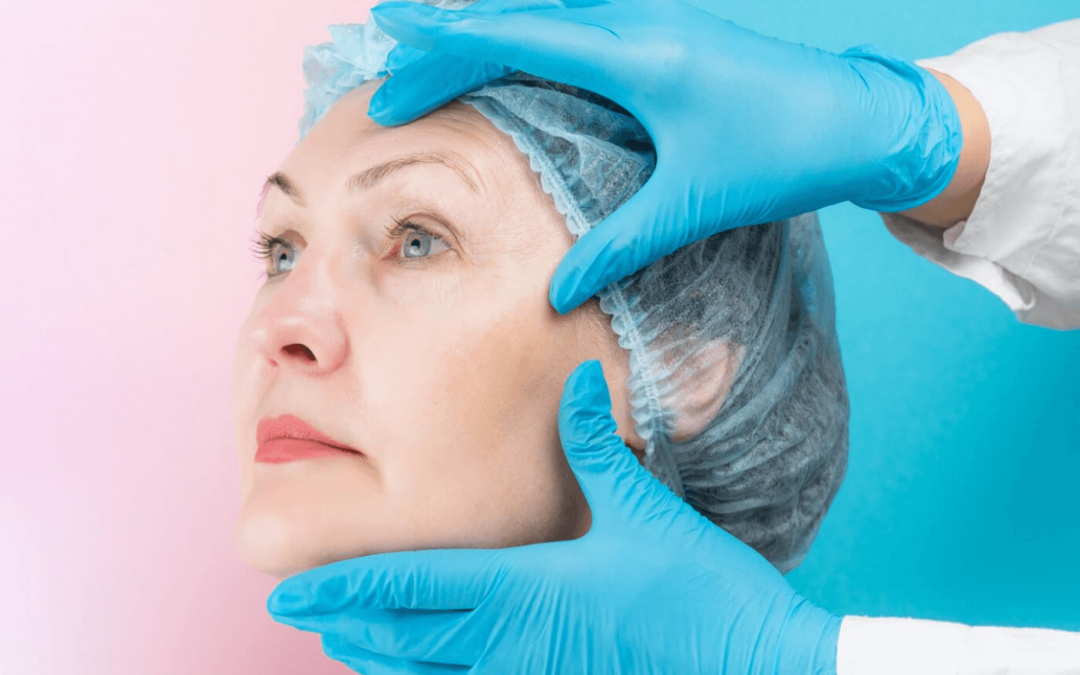 Subperiosteal Facelift in Turkey