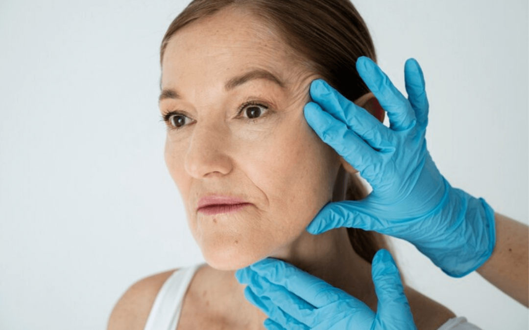 Signs of a Botched Facelift