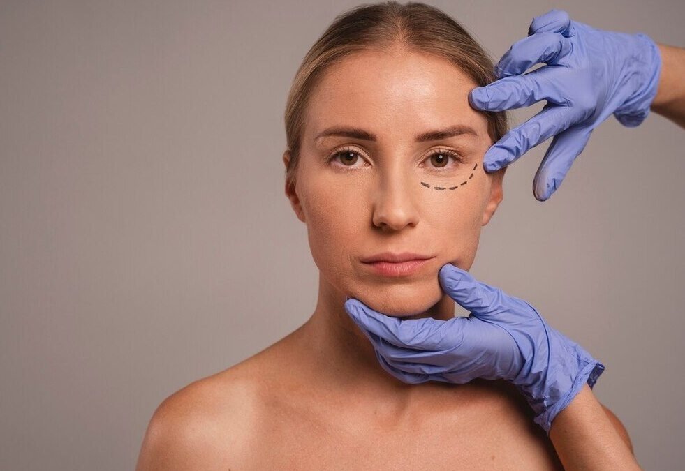 The Ultimate Guide to Vertical Face Lift in Turkey