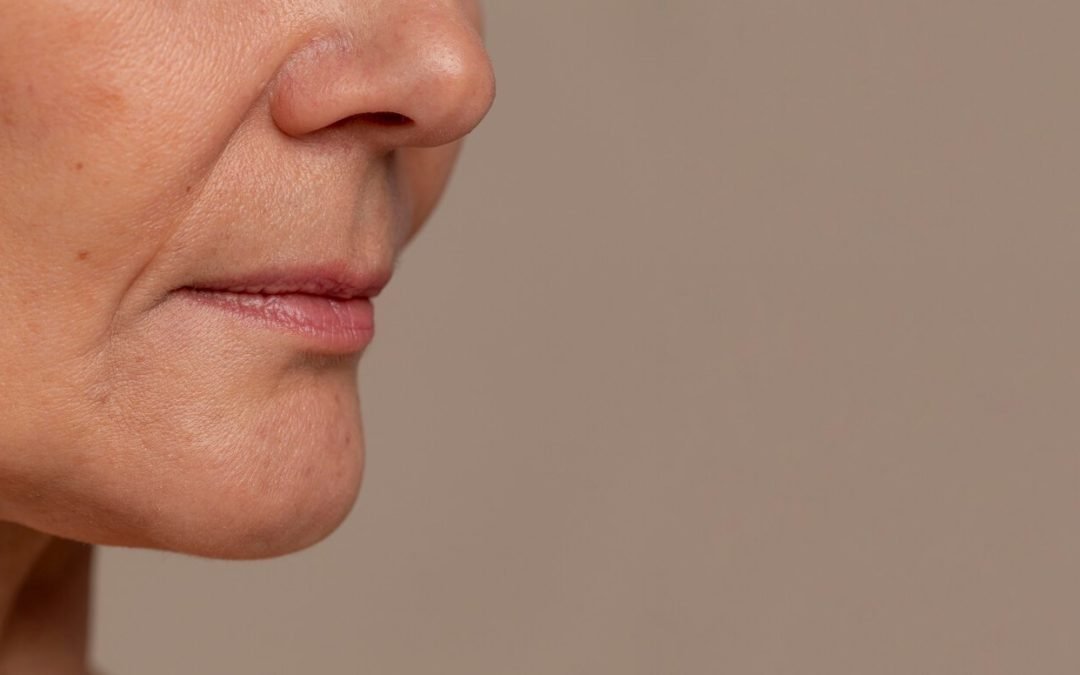 Lower Facelift Turkey