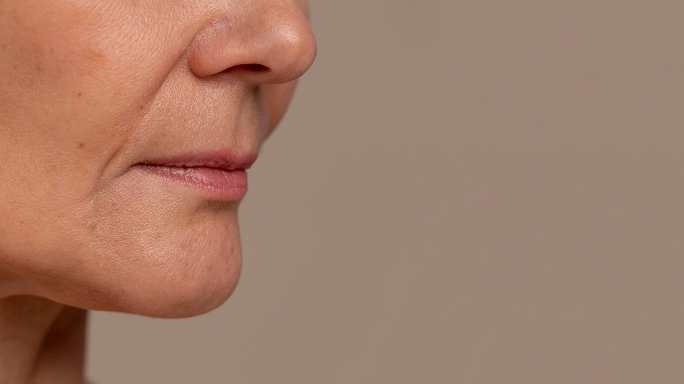 Lower Facelift Turkey