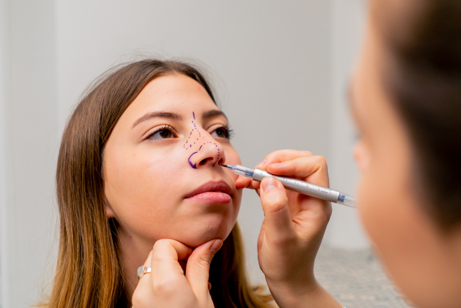 Bulbous Nose Rhinoplasty Turkey