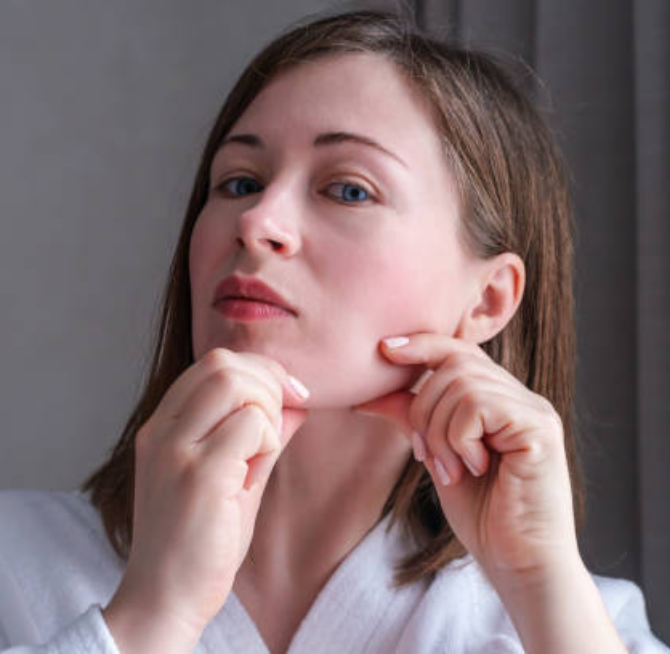 Chin Implant Surgery Turkey