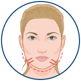 Chin Implant Surgery Turkey