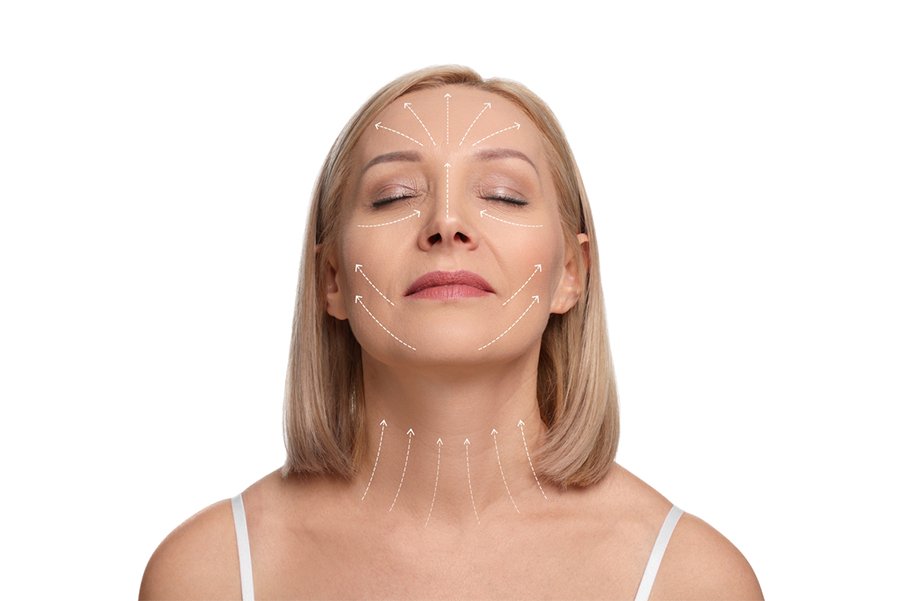 Facelift and Necklift Before and After: Smoking and Alcohol