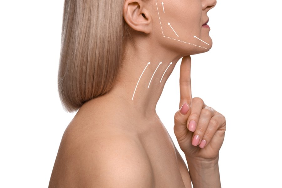 Facelift and Necklift Before and After: Smoking and Alcohol