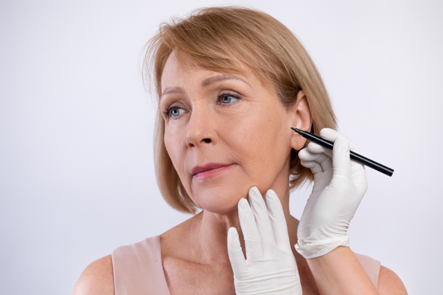When Are Stitches Removed After Facelift Surgery?