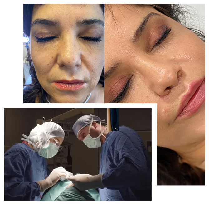 Face Aesthetics in Turkey
