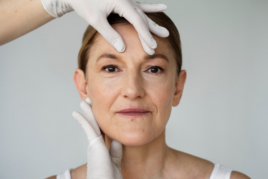 how-long-after-facelift-do-the-stitches-typically-have-to-come-out