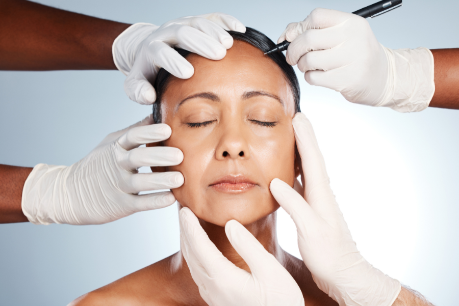 When Are Stitches Removed After Facelift Surgery?