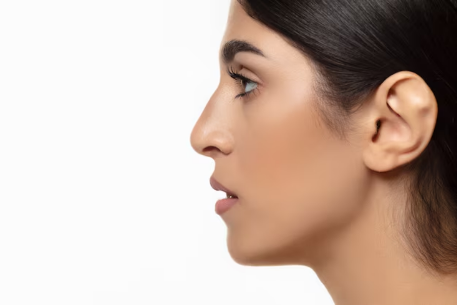 19 Questions To Ask Before Rhinoplasty