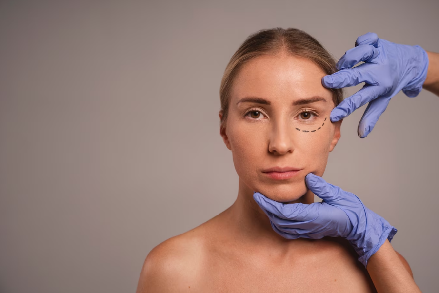 When Are Stitches Removed After Facelift Surgery?