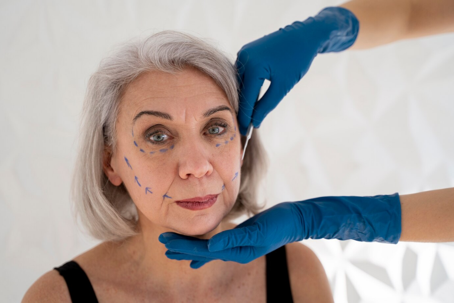 Failed Facelift: Risks, Causes, Consequences