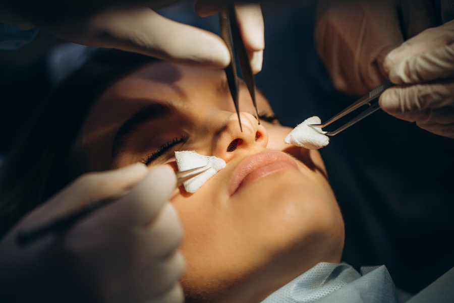 Will There Be Any Scars After Rhinoplasty?