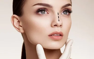 Rhinoplasty in Turkey