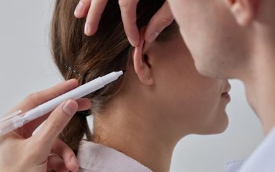 Otoplasty Surgery in Turkey (Ear Aesthetics)