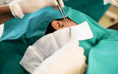 Otoplasty Surgery in Turkey (Ear Aesthetics)