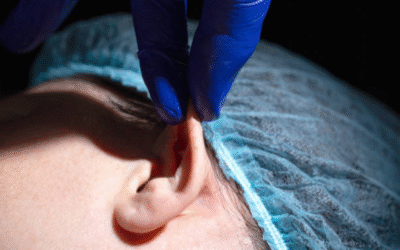 otoplasty-scarring-will-ear-surgery-leave-visible-scars