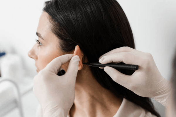 How to Choose the Best Otoplasty Surgeon in Turkey