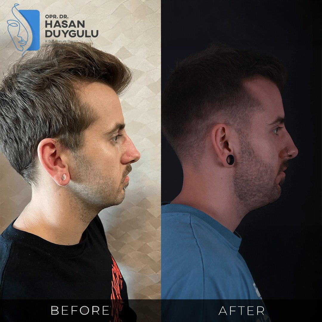 Before After Gallery