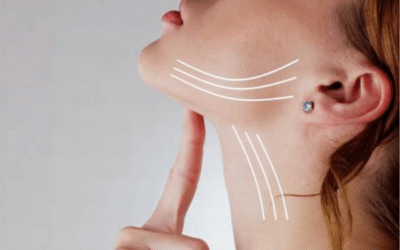 Lifting del collo Turchia