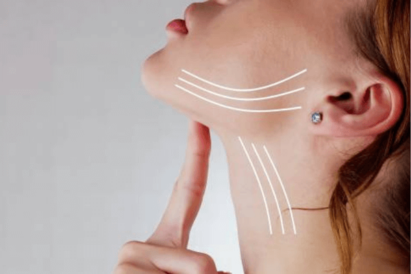 Chin Lipo & Neck Lipo vs Neck Lift