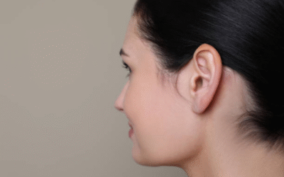 recovery-after-prominent-ear-correction-what-to-watch-for