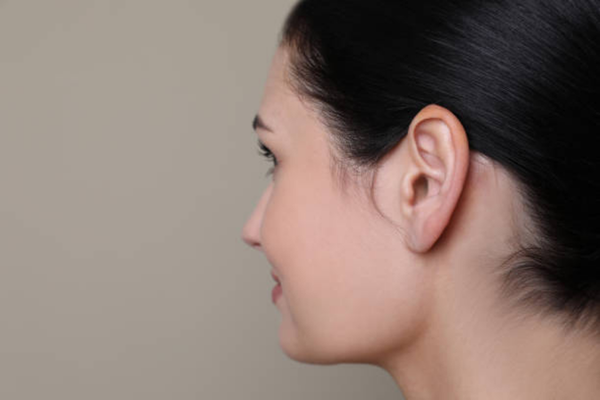 Recovery After Prominent Ear Correction: What to Watch For