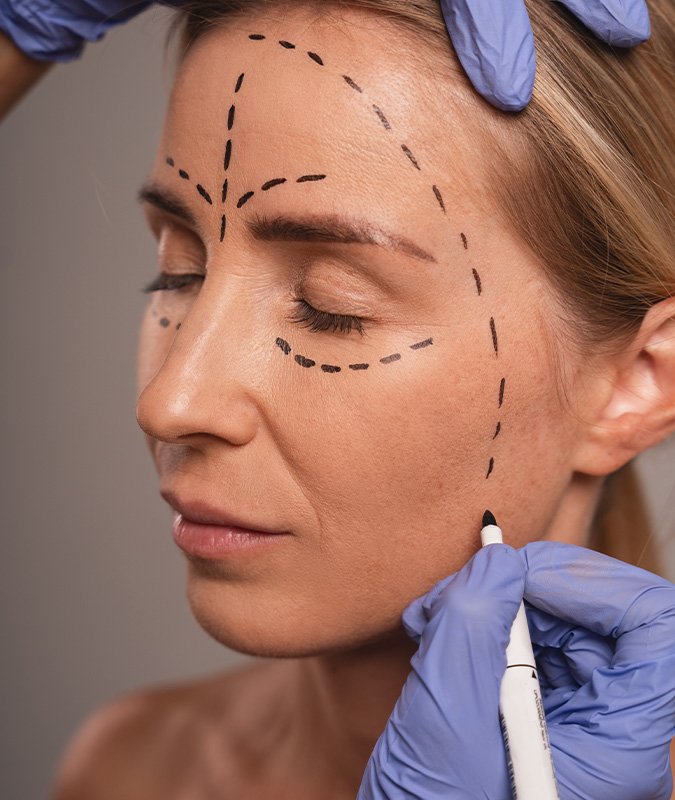 Cat Eyes Surgery Turkey Cat Eyes Surgery Turkey