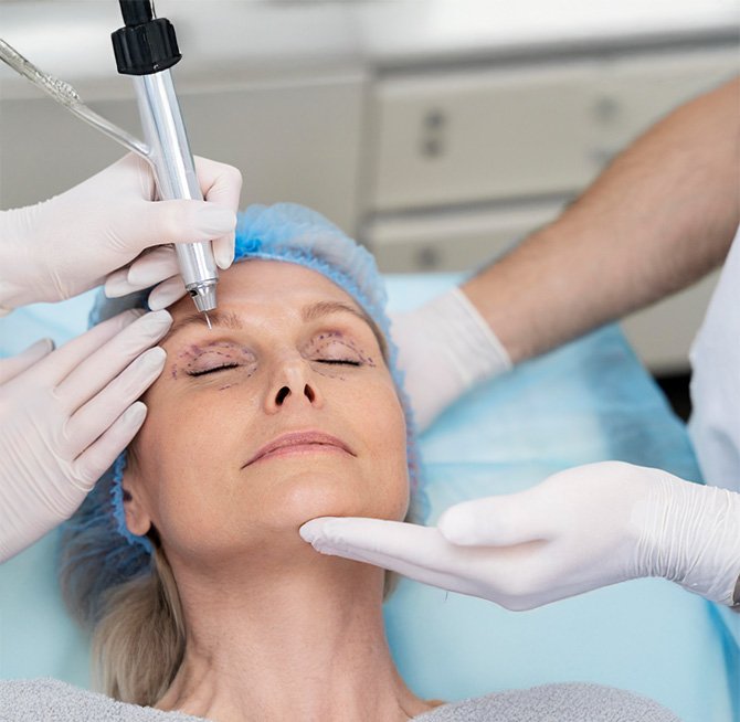 Cat Eyes Surgery Turkey