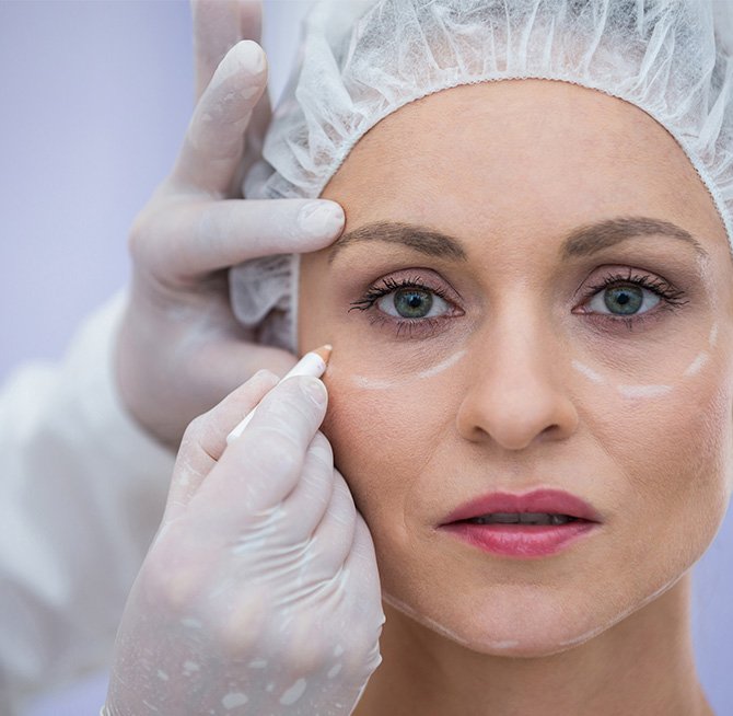 Cat Eyes Surgery Turkey