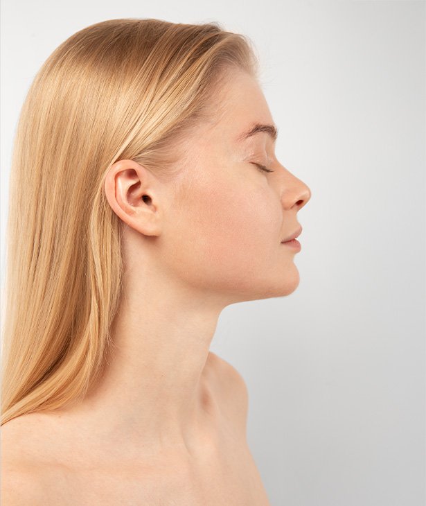 Profiloplasty Turkey