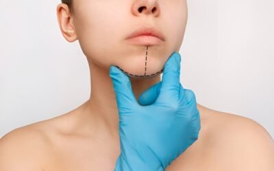 Chin Implant Surgery Turkey