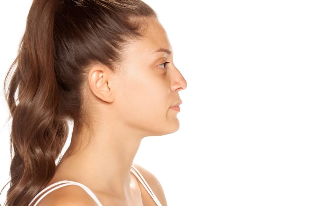 Roman Nose (Hawk Rhinoplasty)