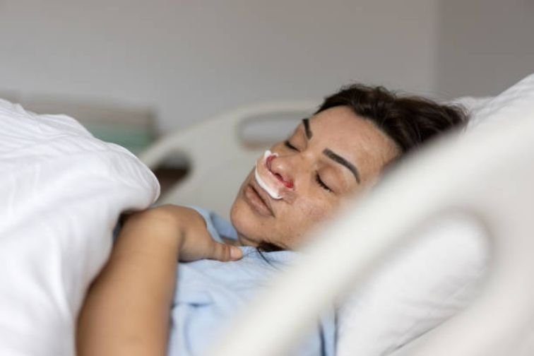 will-rhinoplasty-stop-my-snoring